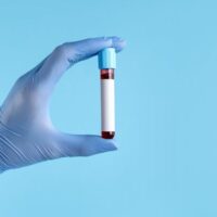 BloodTest3